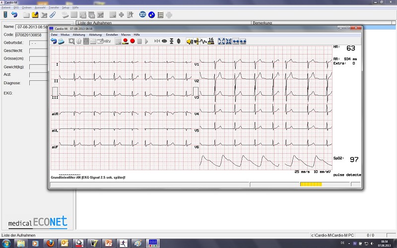Cardio M-PC PC EKG System